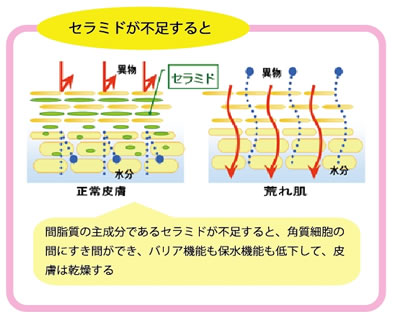 セラミドが不足すると